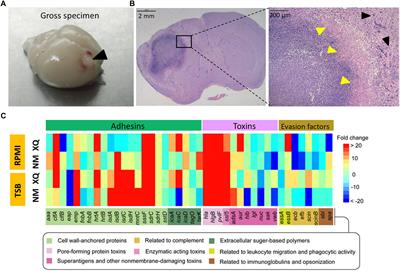 Virulence Determinants Are Required for Brain Abscess Formation Through Staphylococcus aureus Infection and Are Potential Targets of Antivirulence Factor Therapy